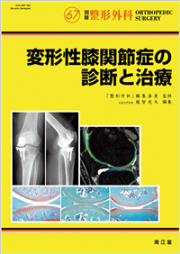 No.67 変形性膝関節症の診断と治療