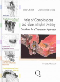 Atlas of Complications & Failures in Implant Dentistry- Guidelines for a Therapeutic Approach