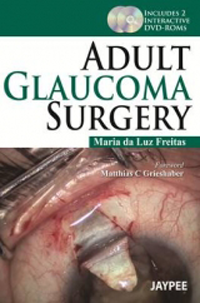 Adult Glaucoma Surgery