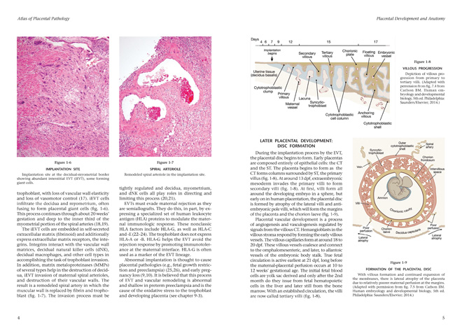 Fascicle 6 胎盤の病理学