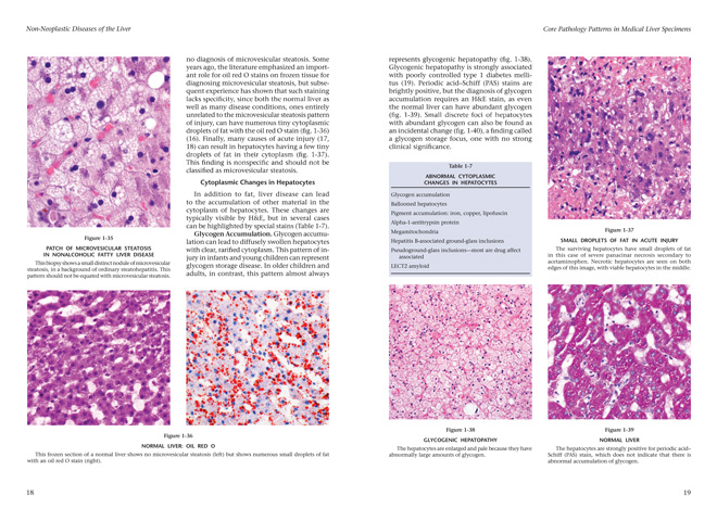 Fascicle 10 肝臓の非腫瘍性疾患