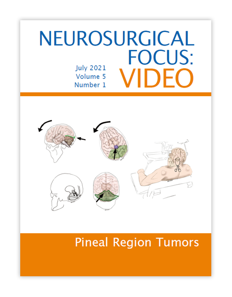 Journal of Neurosurgery (JNS)