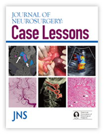 Journal of Neurosurgery (JNS)