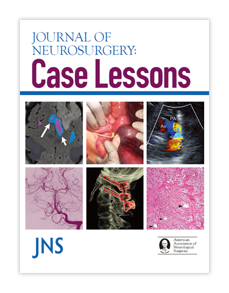 Journal of Neurosurgery (JNS)