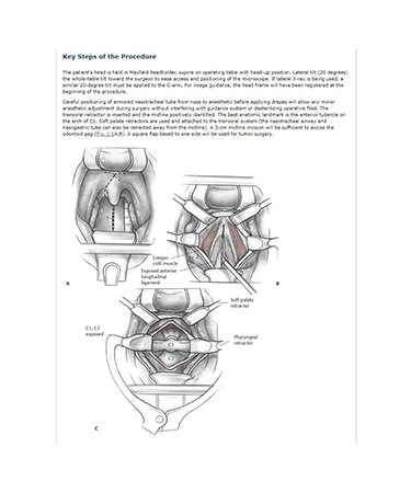 procedures1