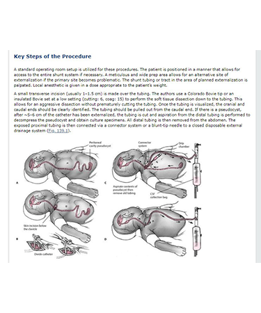 procedures3