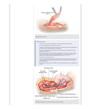 procedures3