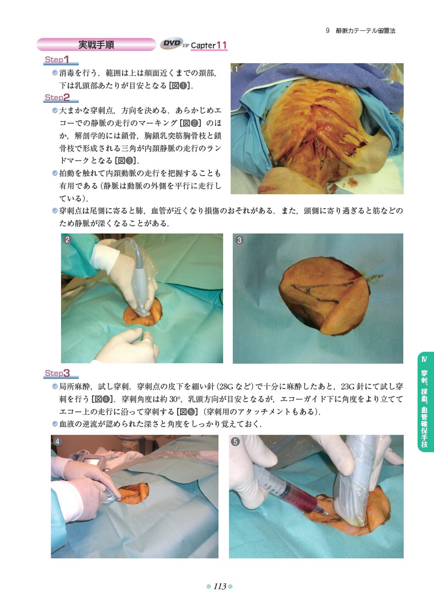 実用中国手技療法 基本編　臨床編　2冊セット 実用中国手技療法 臨床編 (GAIA BOOKS) | 張 軍 |本 | 通販 | Amazon