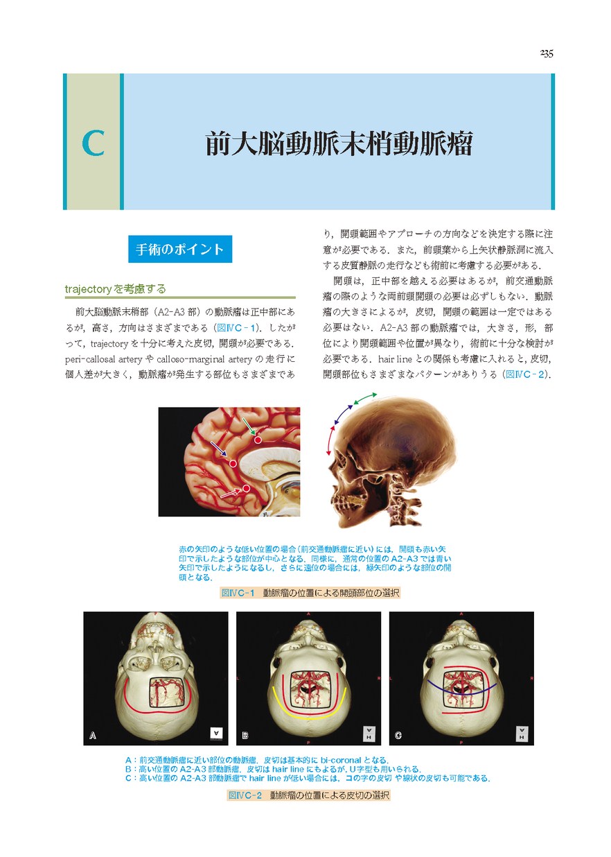 脳動脈瘤手術
