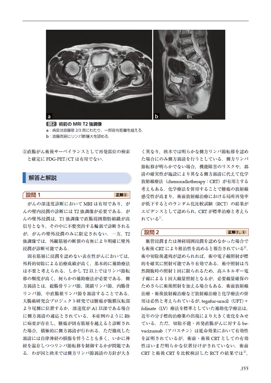 臨床放射線腫瘍学