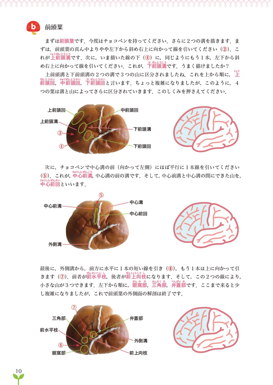 よくわかる脳の障害とケア