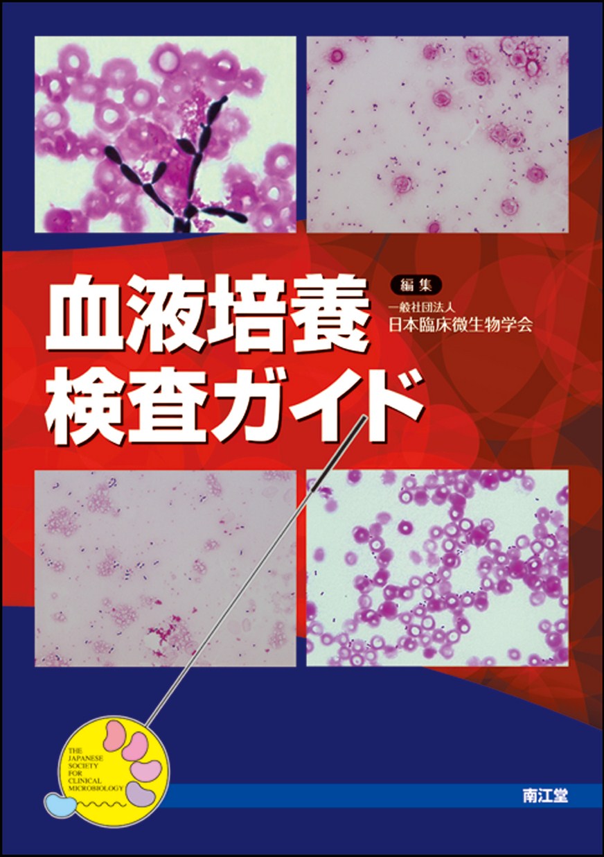 血液培養検査ガイド