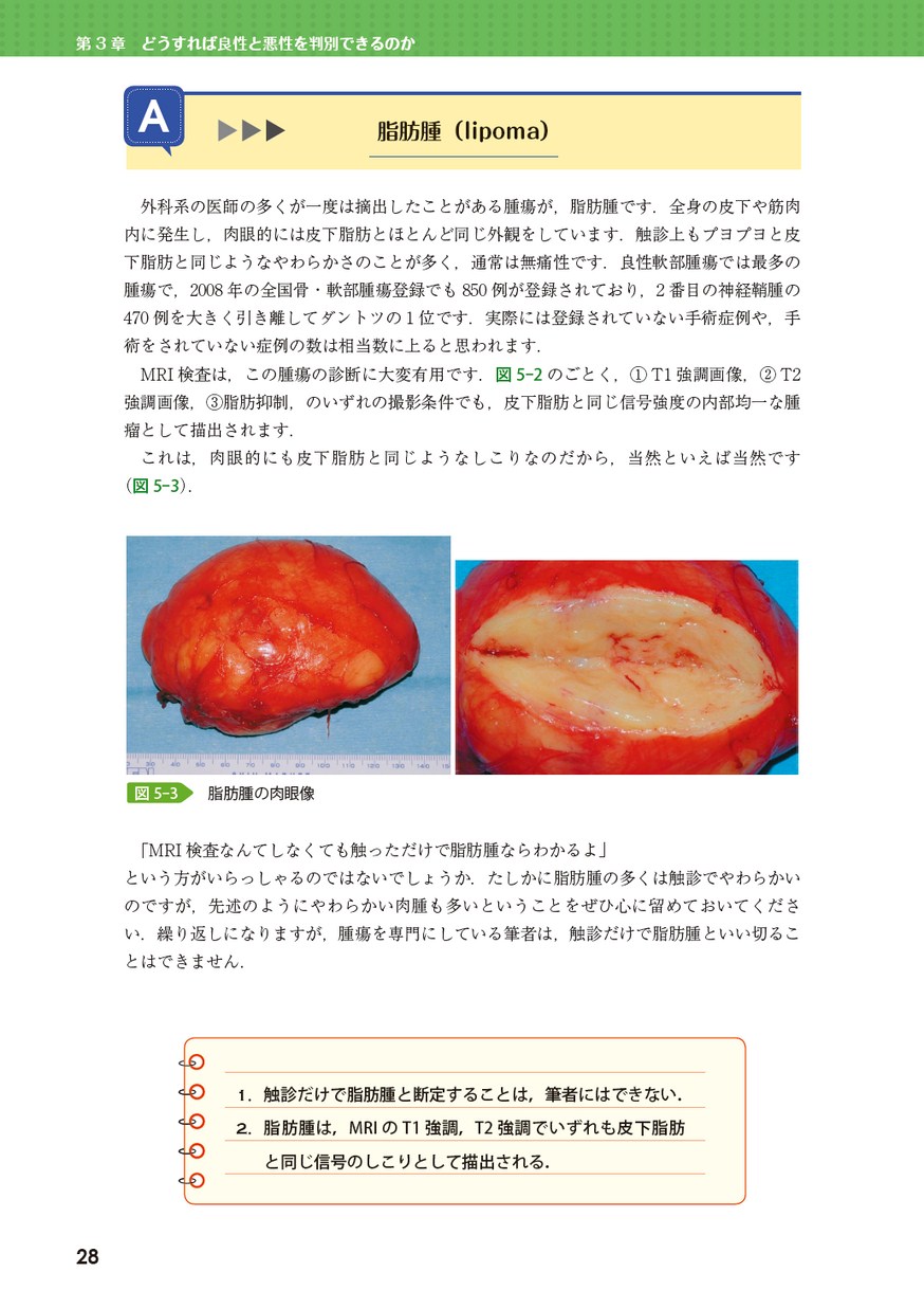 しこりをみたらどう考える? しこりをみたらどう考える?