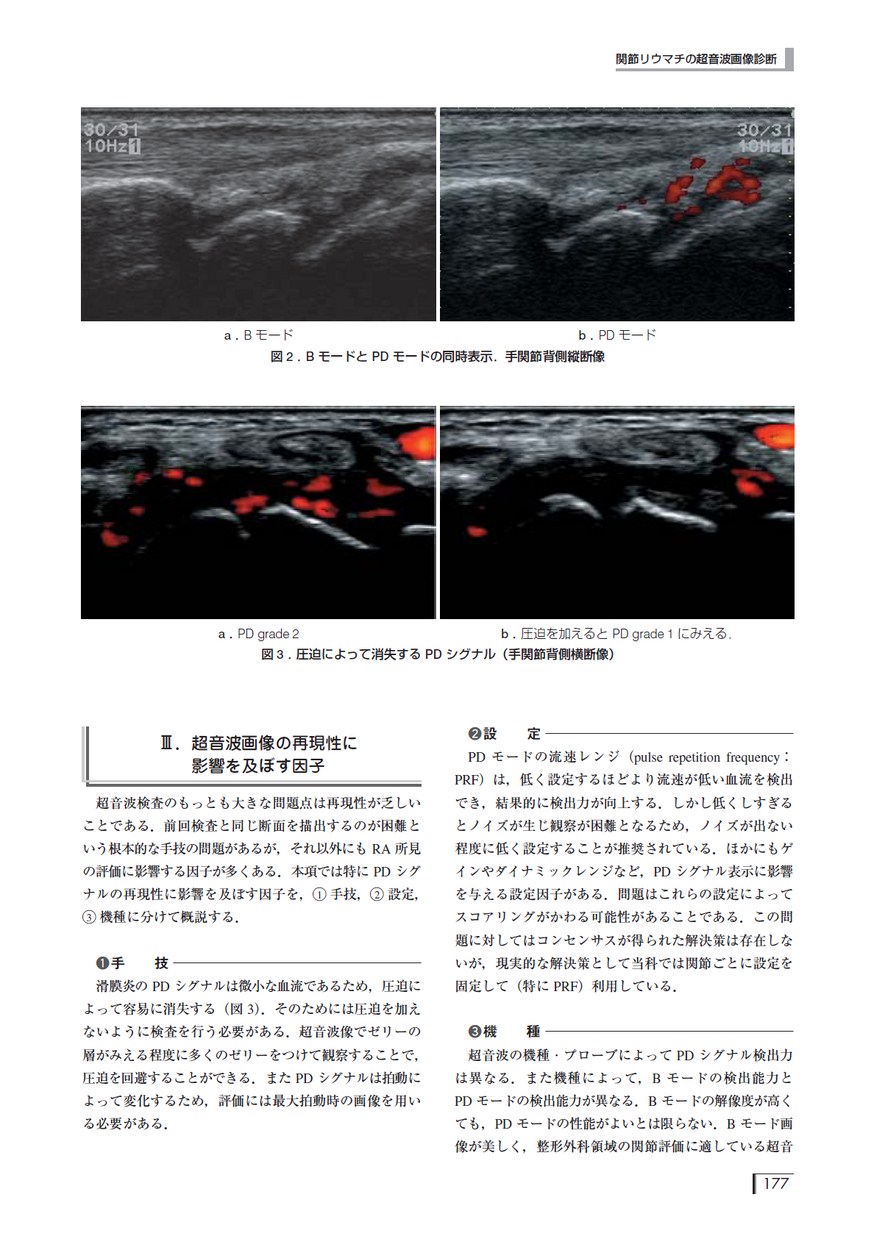 超音波でわかる運動器疾患　診断のテクニック 超音波でわかる運動器疾患−診断のテクニック | 皆川 洋至 |本