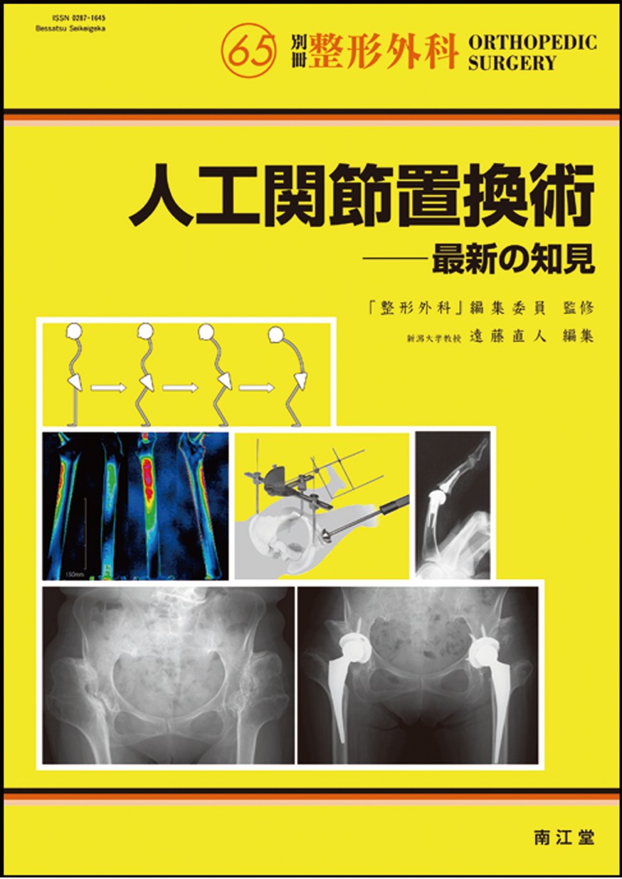 別冊整形外科65：人工関節置換術